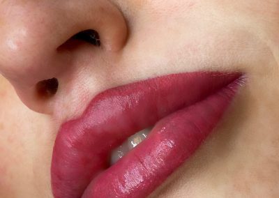 Anna Cappellari Trattamento Bocca